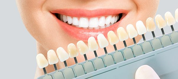 Teeth Whitening Kits: Which One Is Right For You?